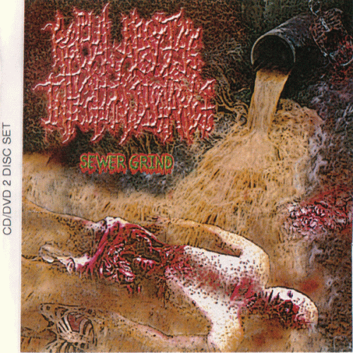 Rectal Abscess Infection Discharge : Sewer Grind